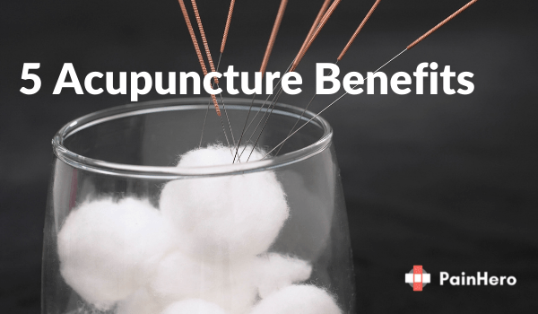 5 acupuncture benefits​