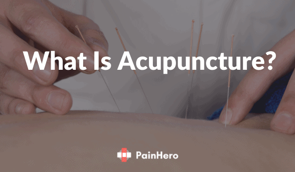 what is acupuncture