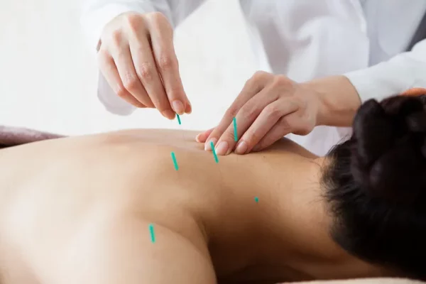 axiom physiotherapy and rehabilitation acupuncture