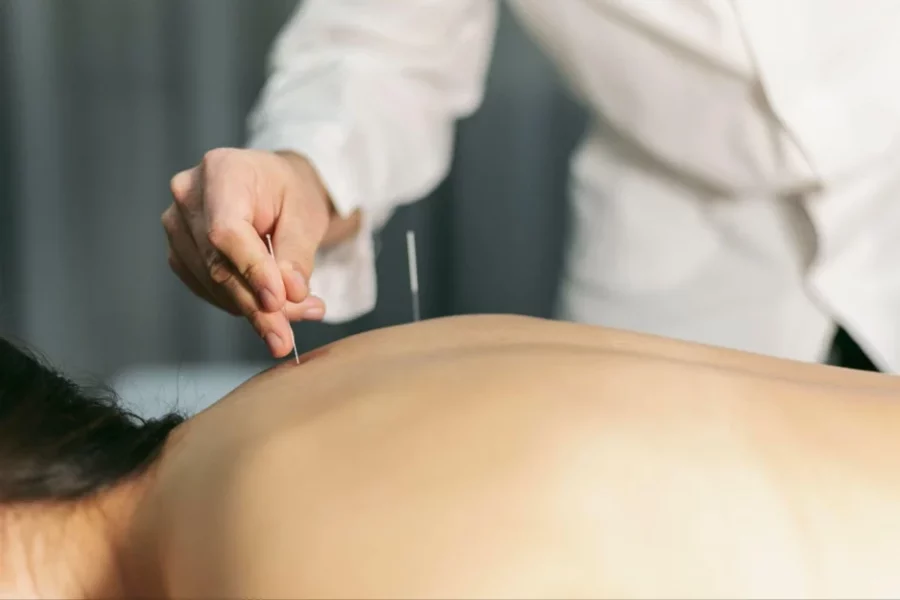 king george physiotherapy and rehab clinic acupuncture