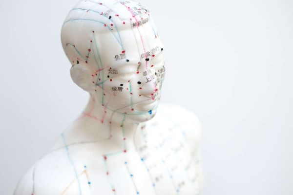 motion fit rehab and wellness acupuncture