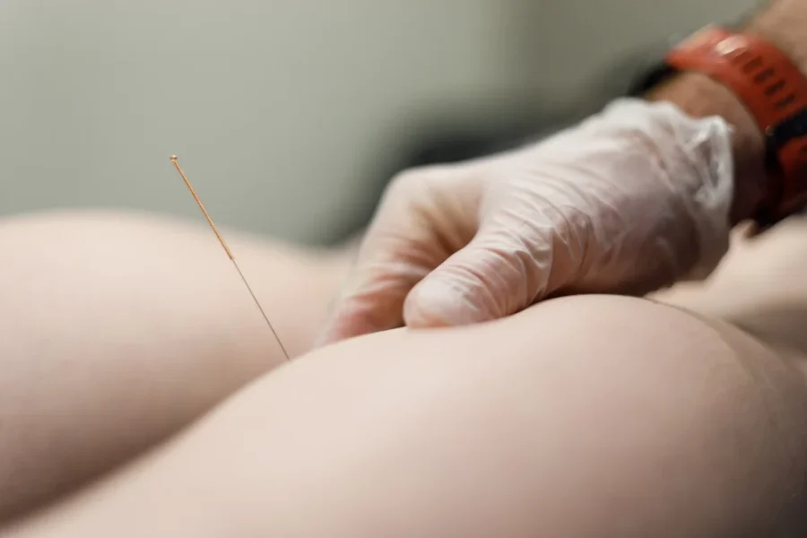 parkway physiotherapy ims dry needling