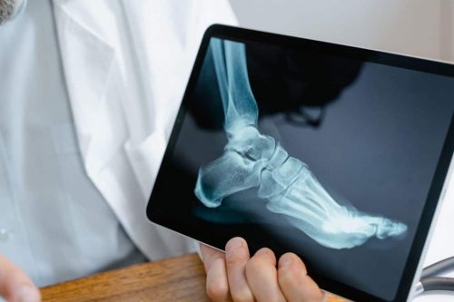 restorative sports therapy imaging referrals